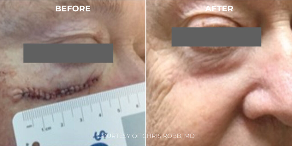 Xcite_Halederma_B&As_Artboard-5