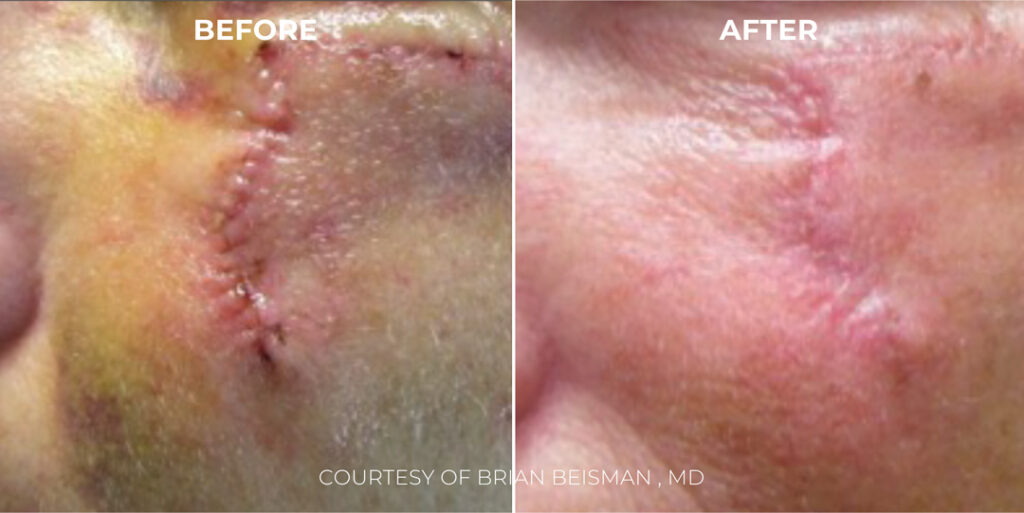 Xcite_Halederma_B&As_Artboard-6